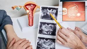 स्त्री बीजांची विक्री! नेमकं करतात काय, महिलांच्या शरीरातून कसे काढतात बीज ?